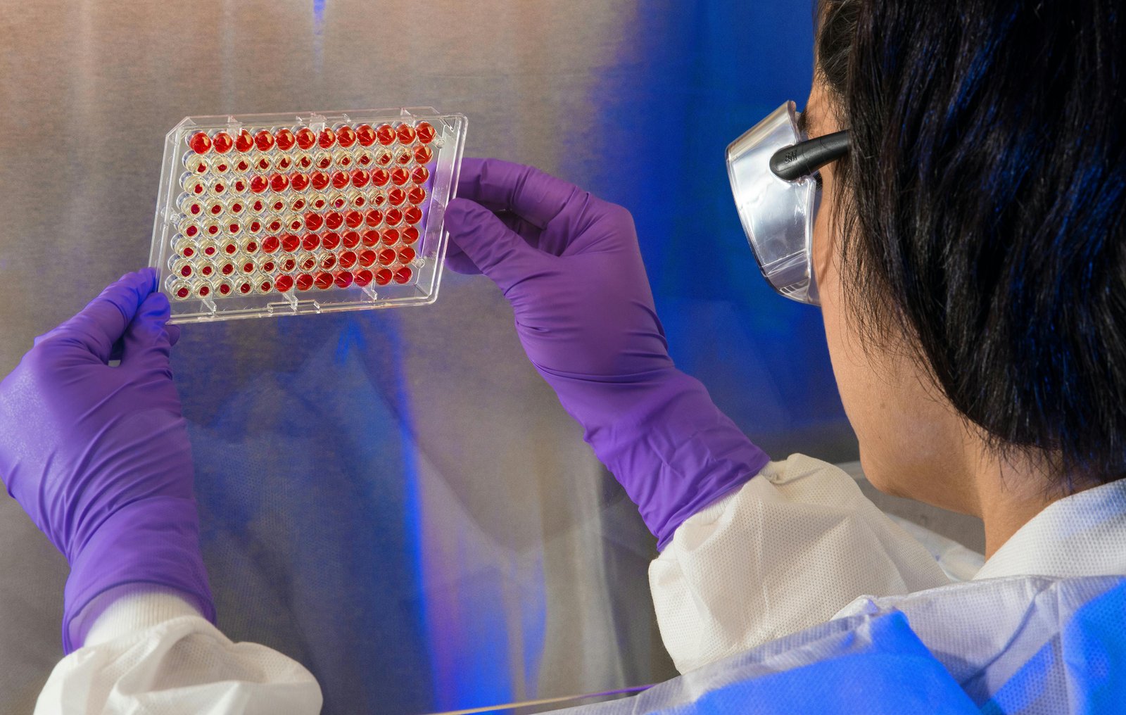SFPQ helps protect repeat DNA from R-loop damage