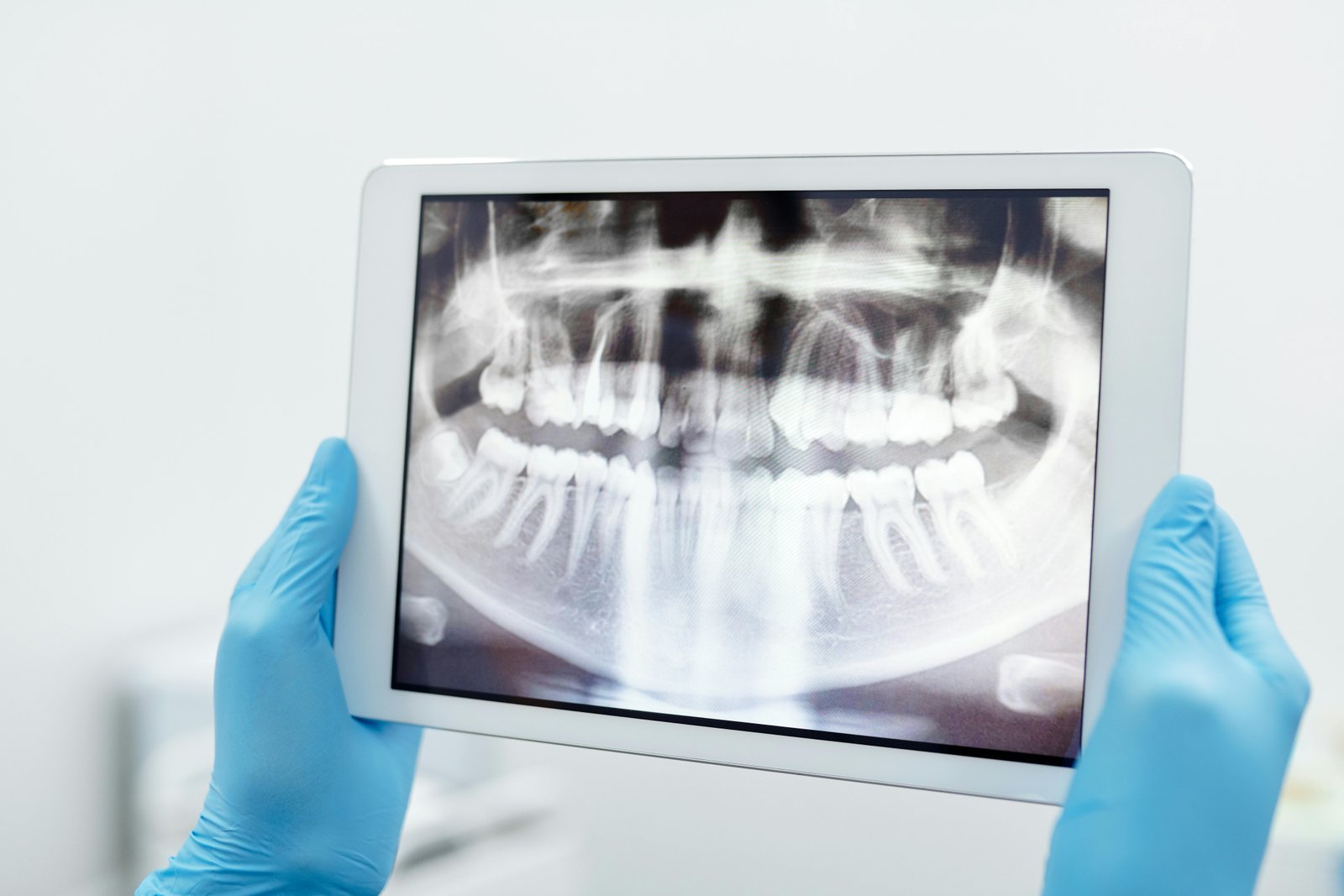 Vision–language model improved pediatric dental disease classification