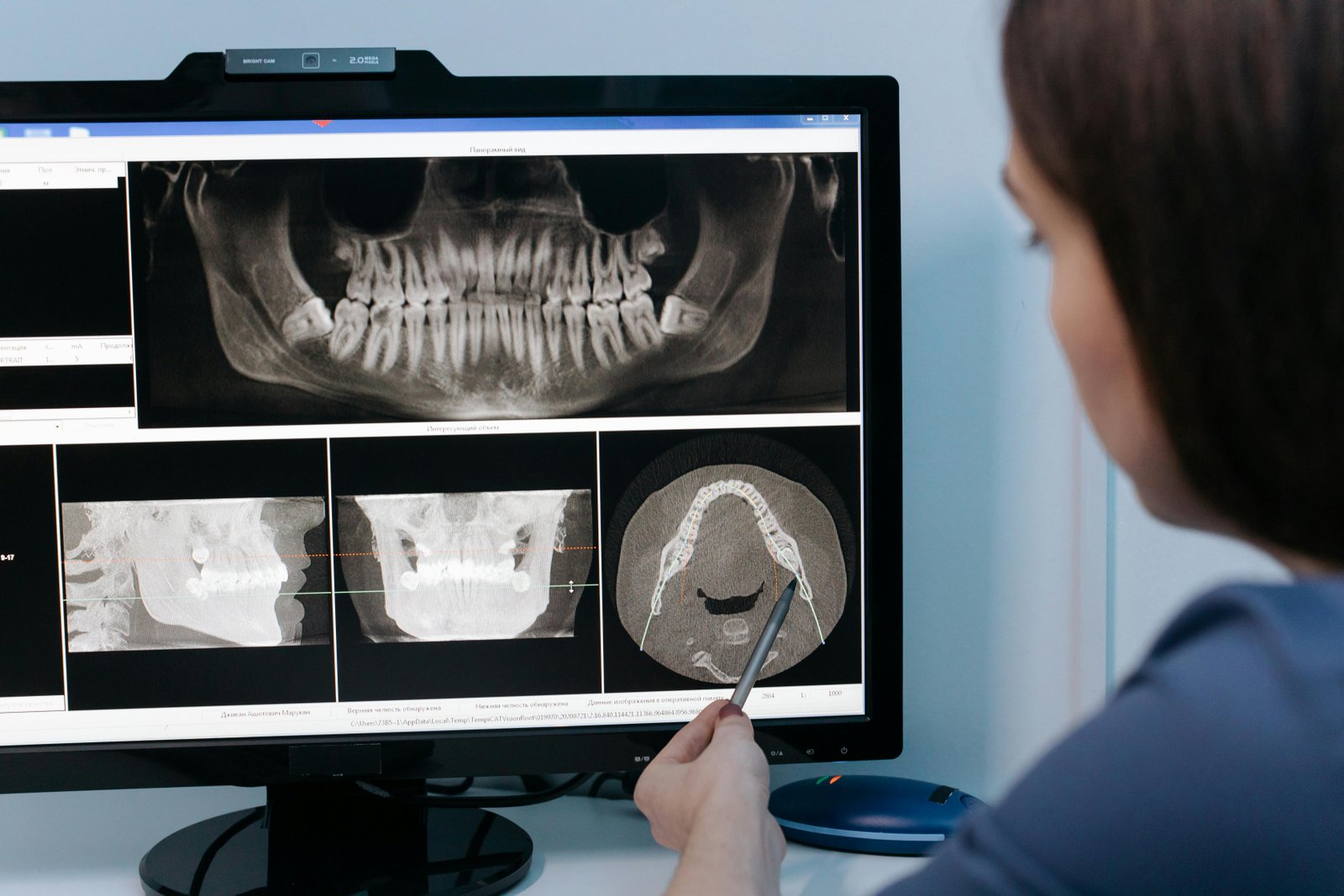 Global Trends in Micro-CT Studies of Root Canal Morphology: A 25-Year Bibliometric Analysis