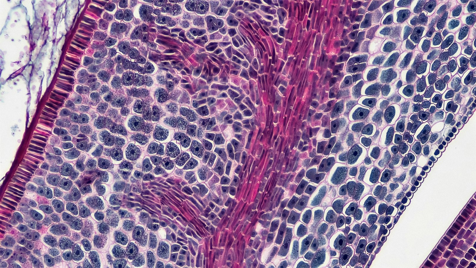 High-resolution spatial transcriptomics maps gut microbiome biogeography