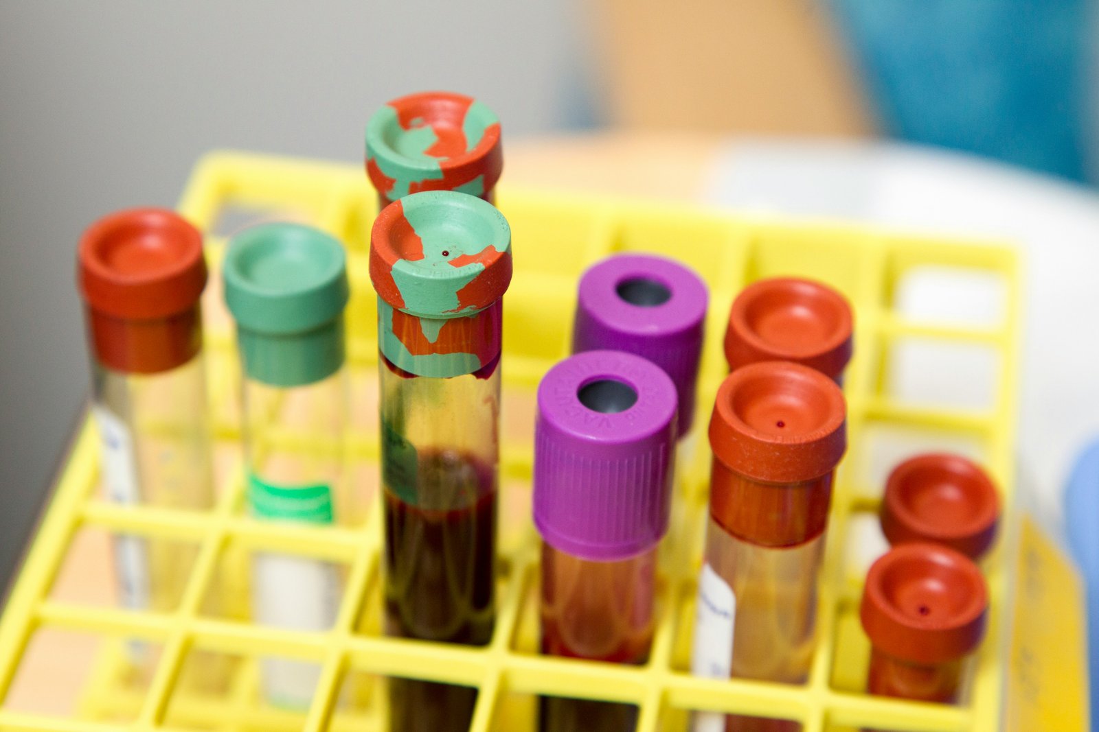 dd-cfDNA tracks kidney rejection activity across the continuum