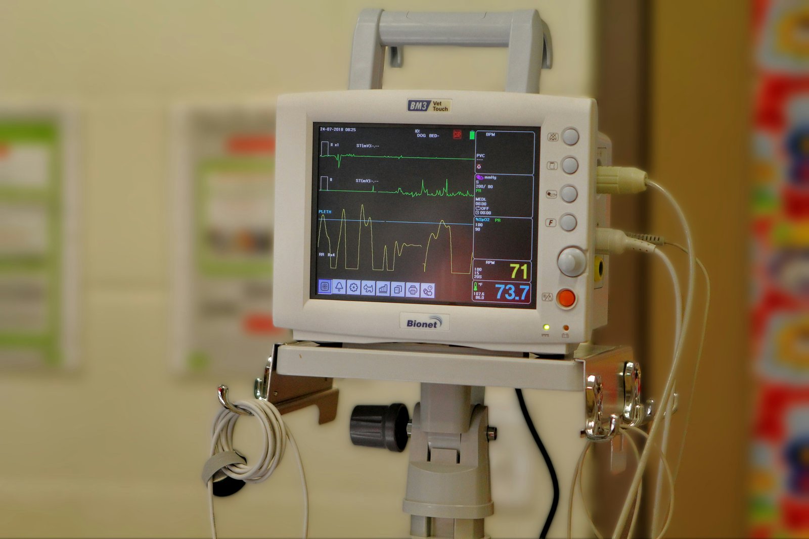 Adult Kawasaki disease linked to coronary vessel wall abnormalities