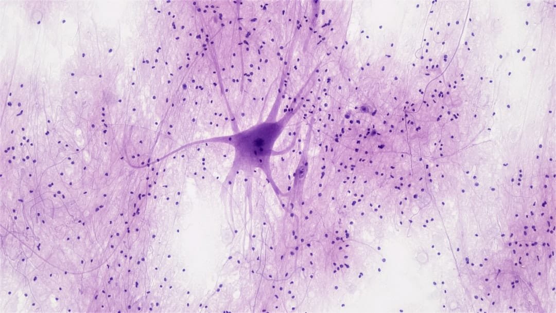 Organic event-based sensors detect neural activity at low energy