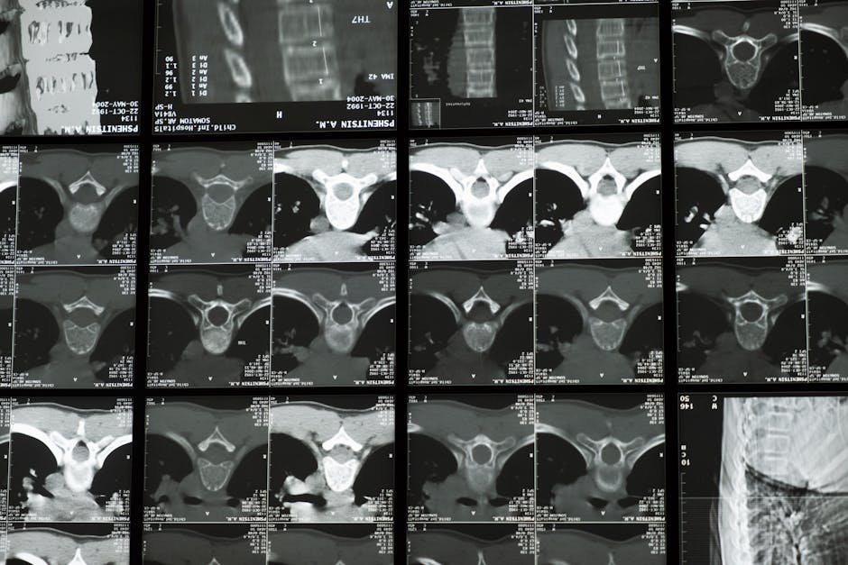 Sagittal CBCT slices estimate facial recess size for cochlear implantation