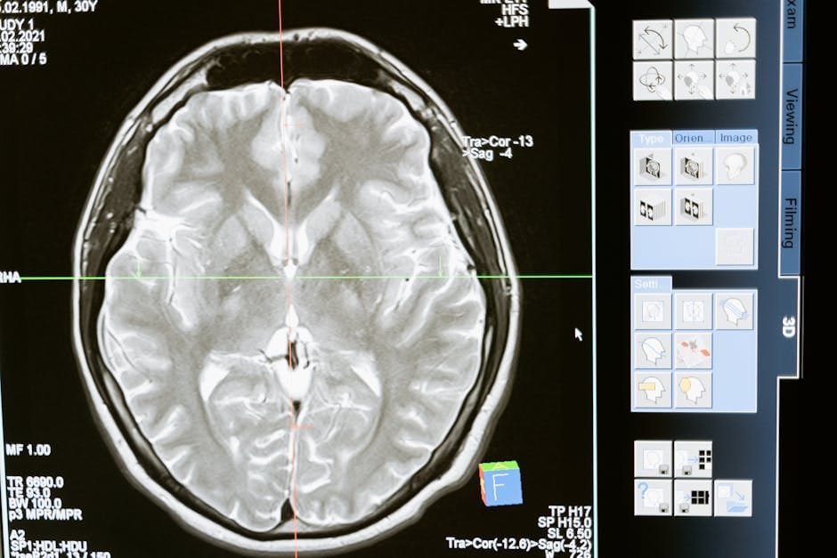 Basal ganglia PVS linked to worse cognitive decline