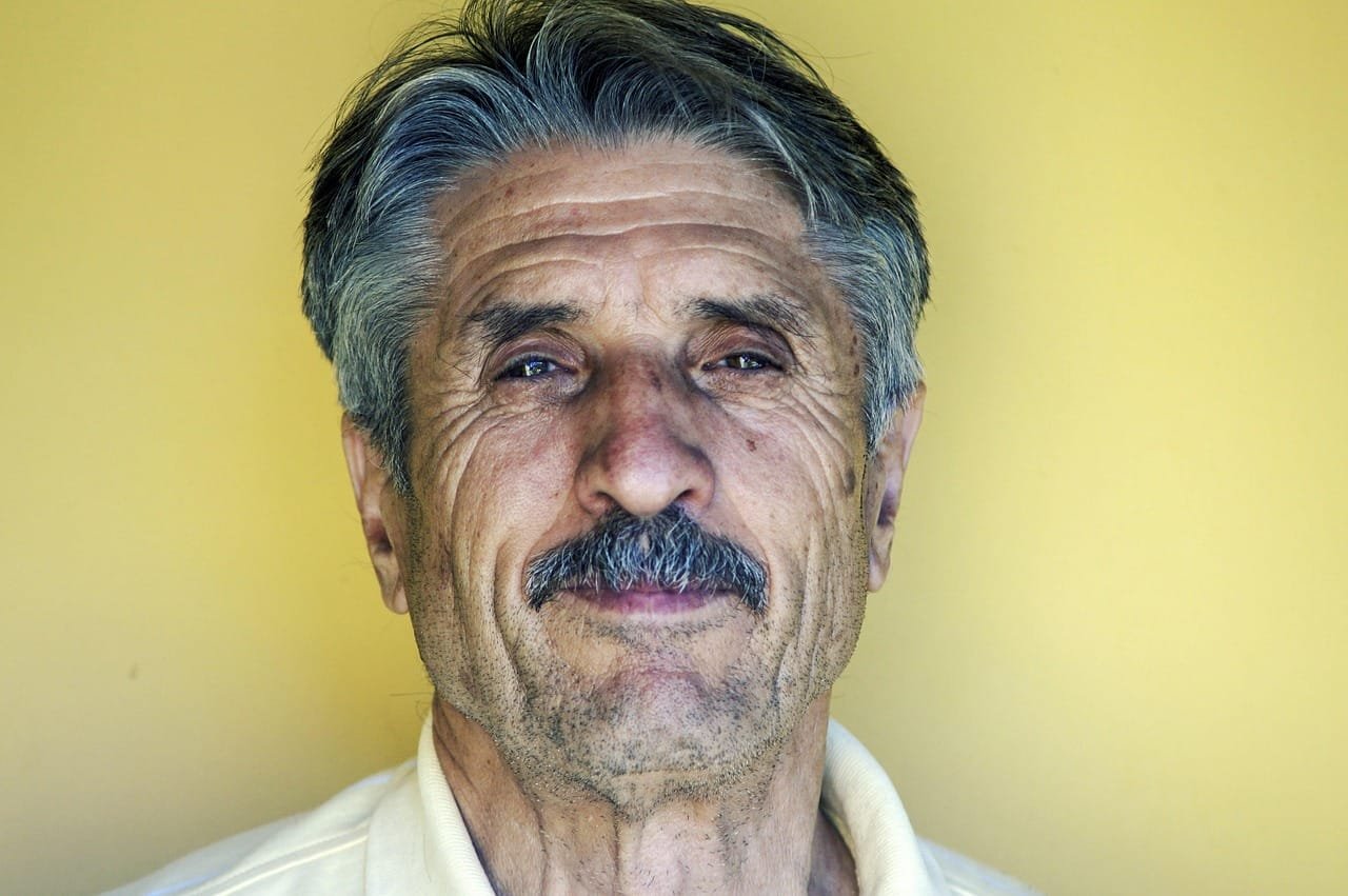 Mild AKI in elderly kidney donors did not worsen graft outcomes