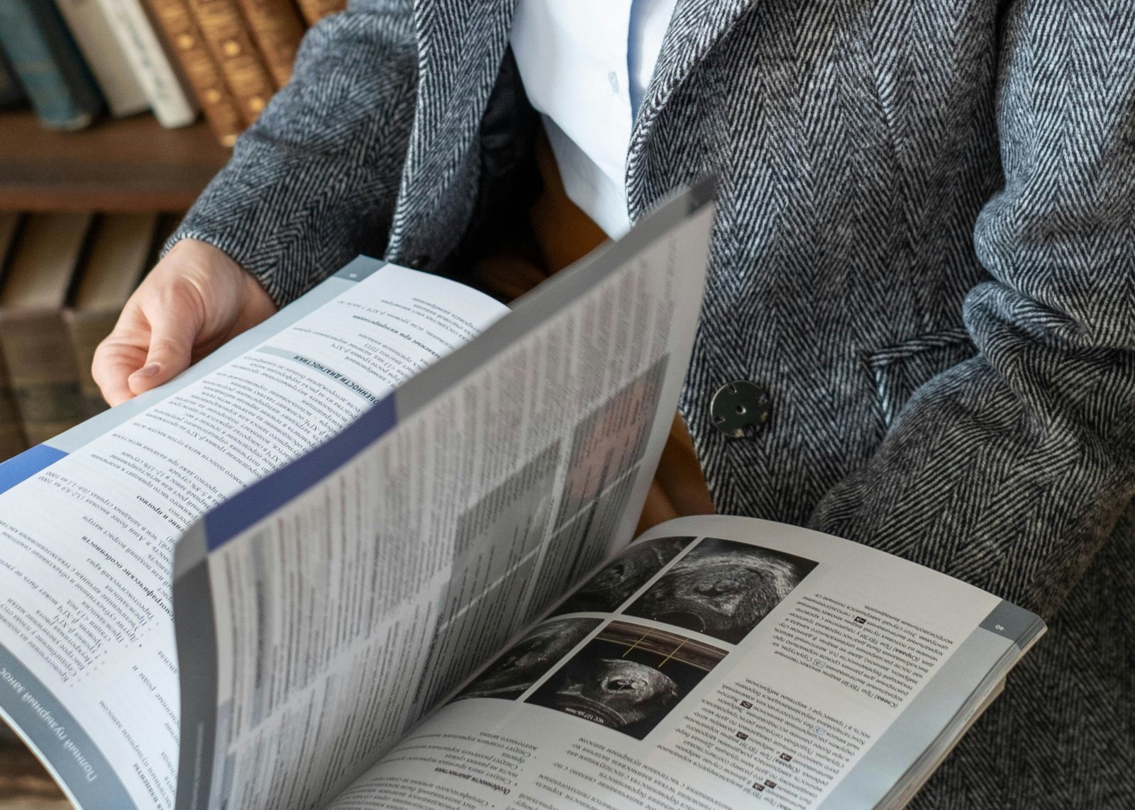 LLM consensus pipeline reduced review filtering effort