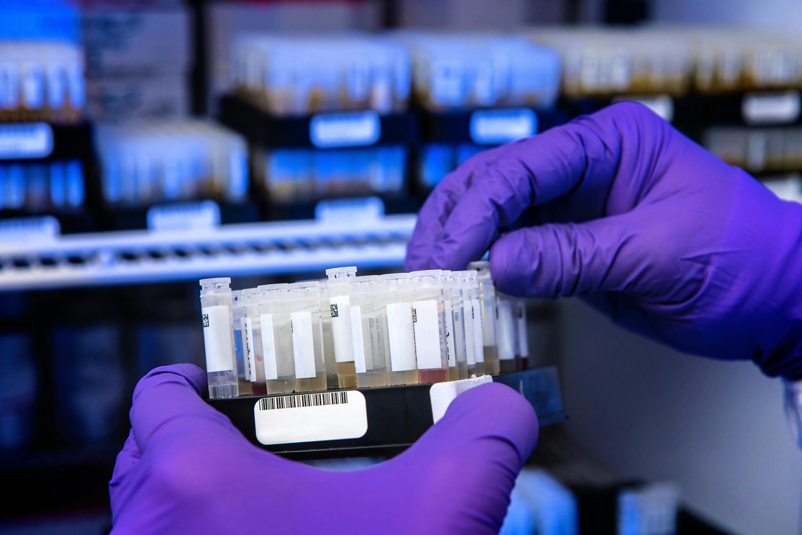 Salivary fingerprinting and neural network identified high-risk periodontitis in diabetes