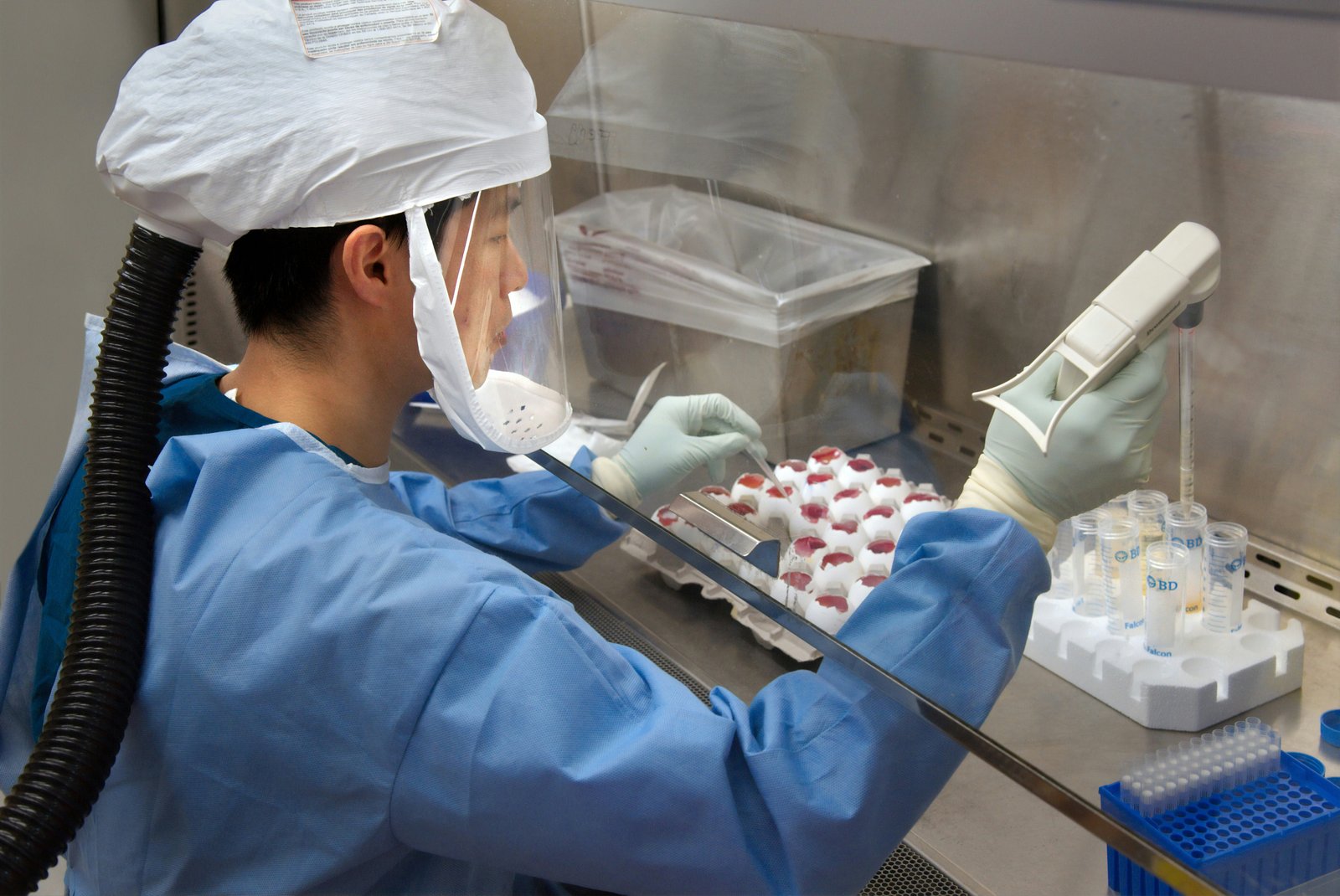 Antibiotic use was linked to long-lasting gut microbiome changes