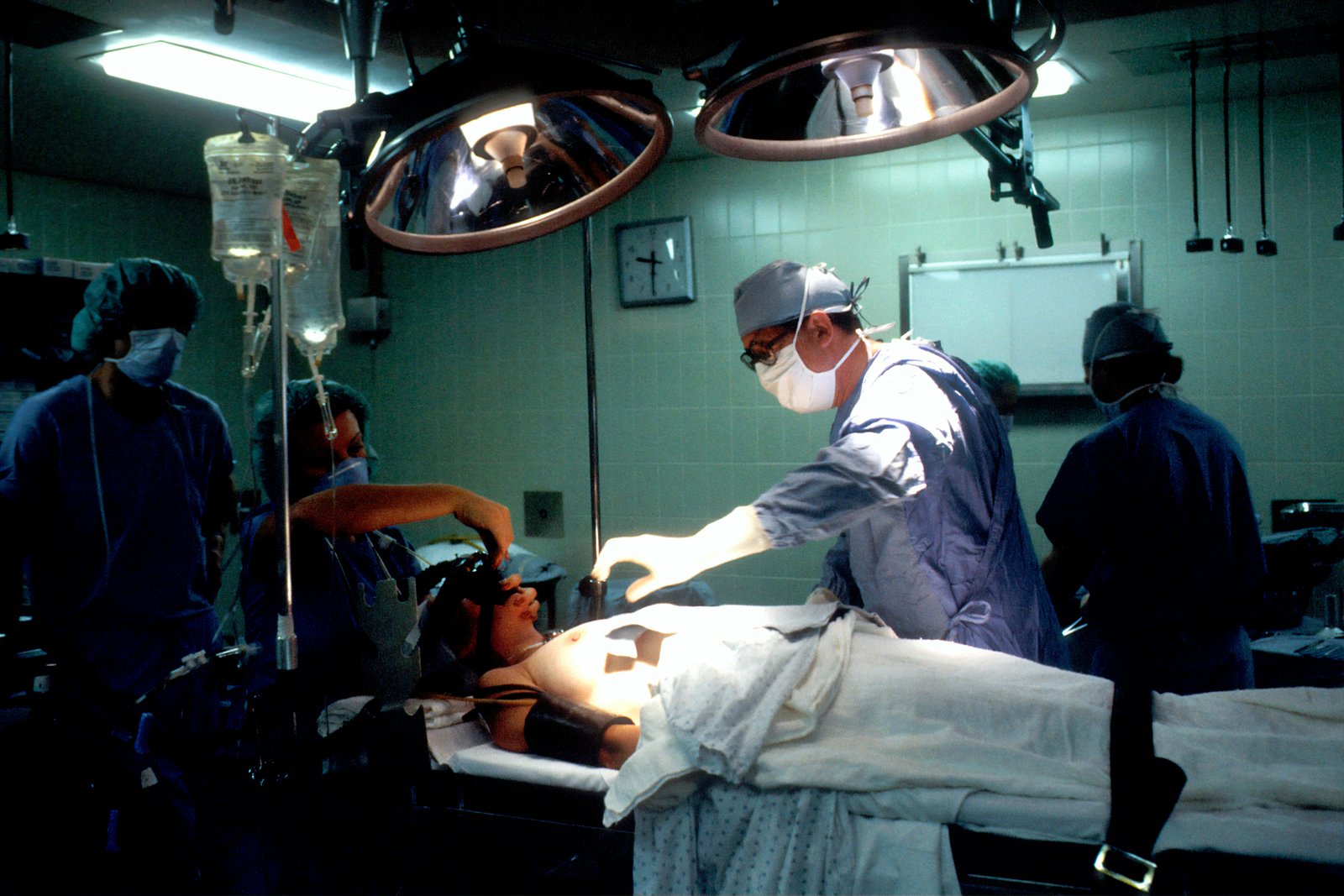 Donor TNFα linked to worse kidney graft outcomes