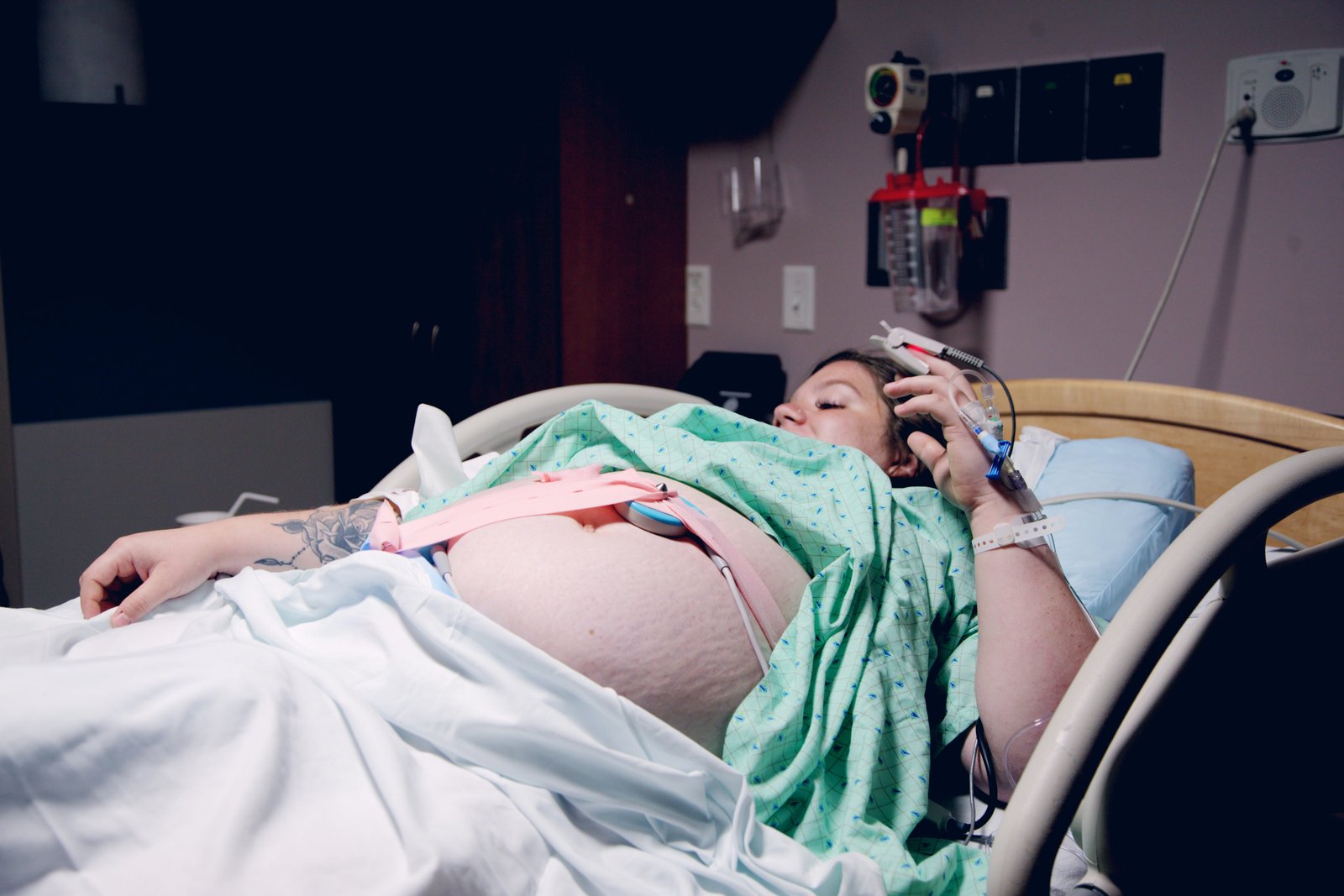 Pregnancy-associated SCAD showed a higher-risk clinical pattern