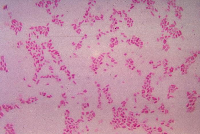 Gut microbiome may affect colorectal cancer immunotherapy response