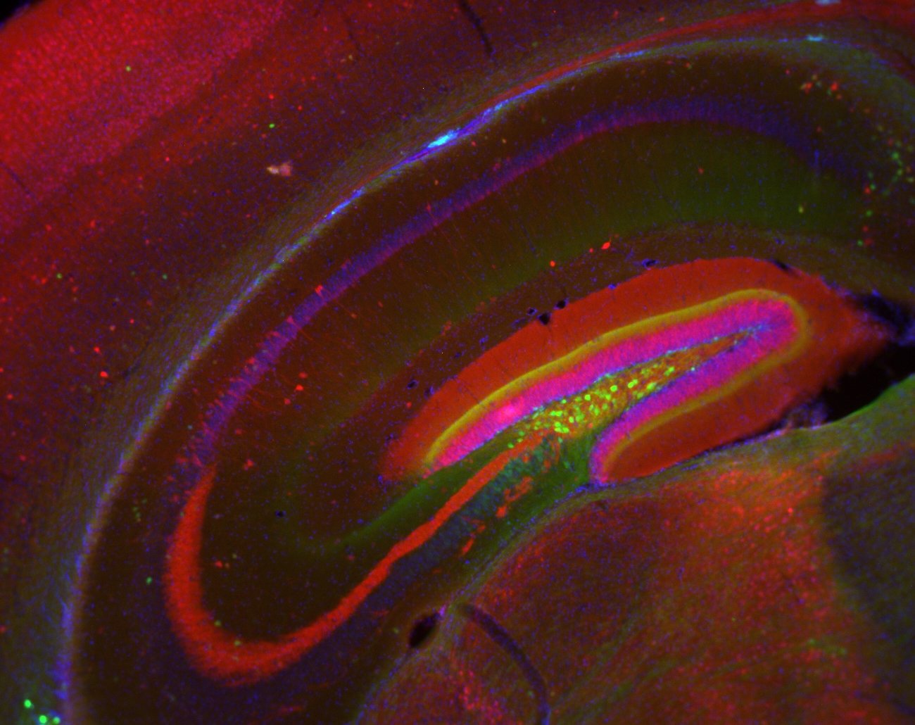 Neuroscience research