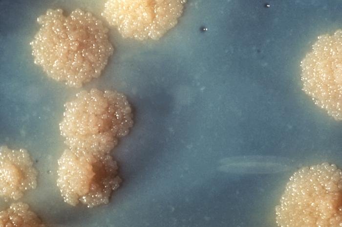 tNGS showed high accuracy for non-sputum tuberculosis detection