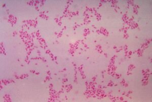 Oncology research