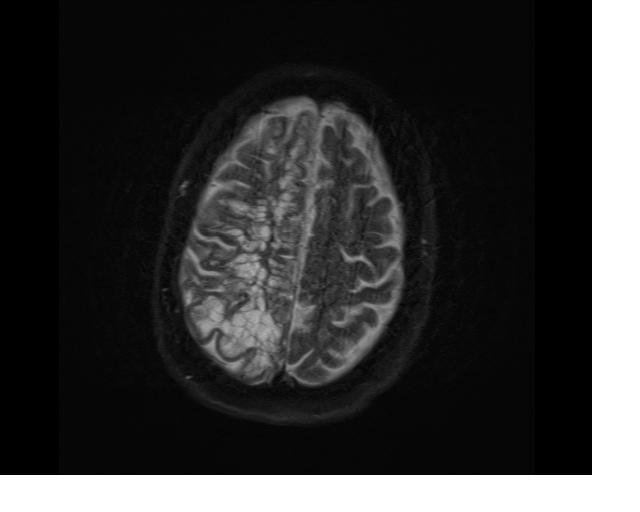 Neuroscience research