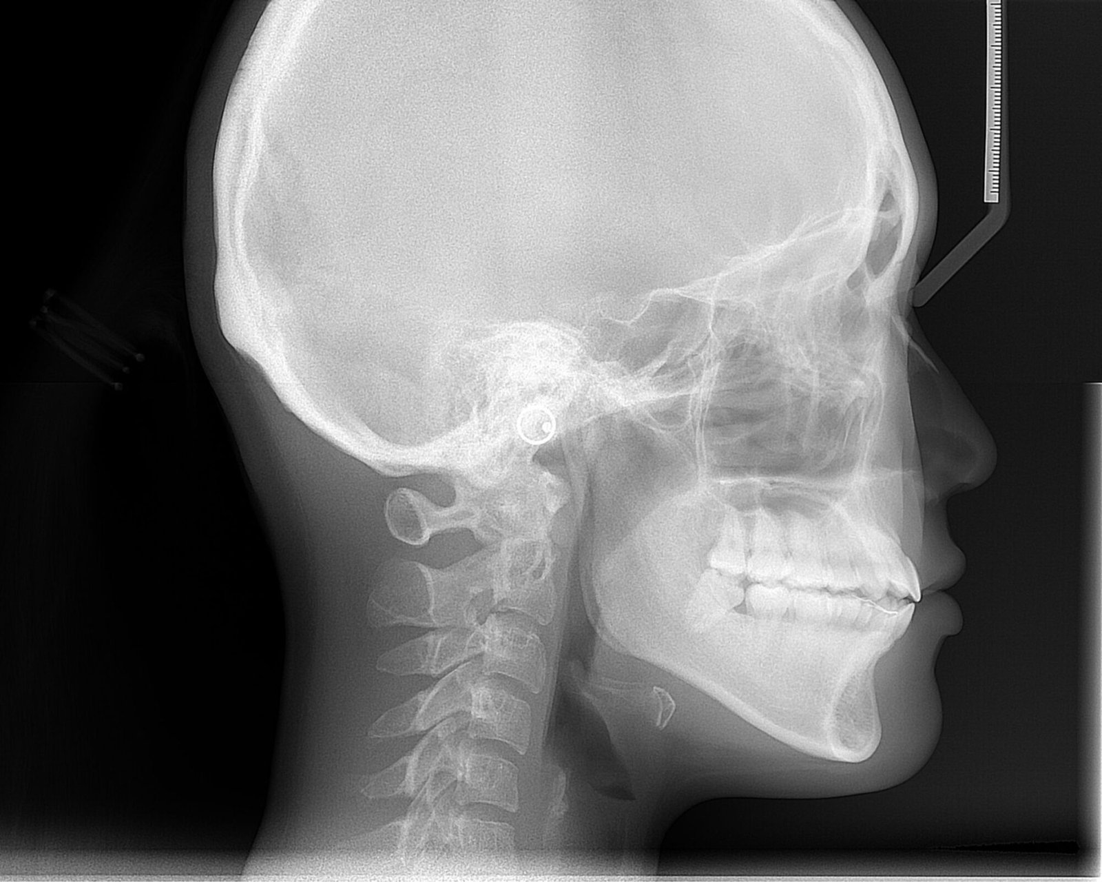 Deep learning mapped craniofacial growth patterns across ages and sex